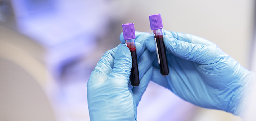 blood-samples.-career-opportunities-after-a-phlebotomy-course-in-kenya